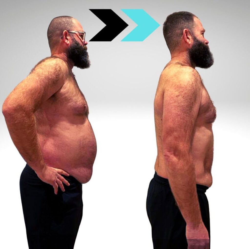 A man stands sideways on to demonstrate a dramatic weight loss